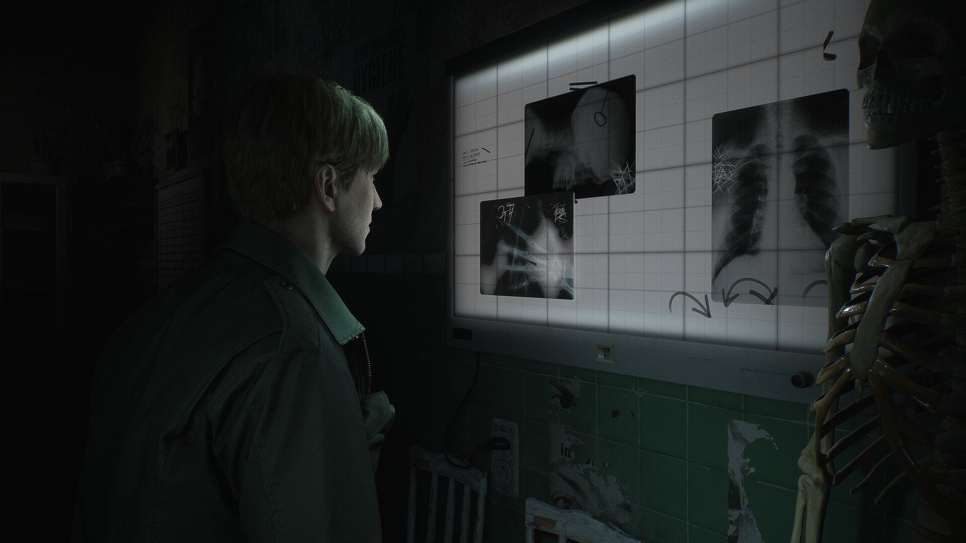 Silent Hill 2 finally coming to PC in its full glory with a Teaser Trailer  - News - Gamesplanet.com