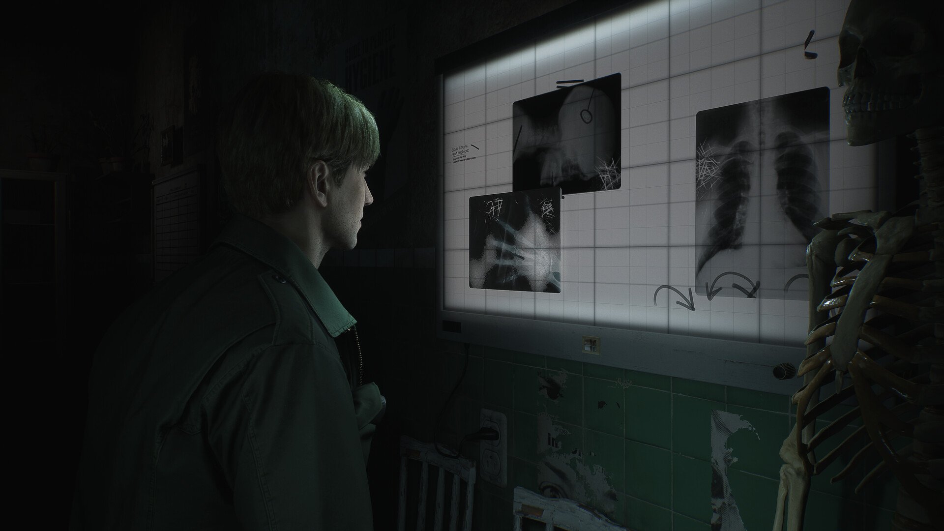 What Layers Of Fear Tells Us About The Silent Hill 2 Remake