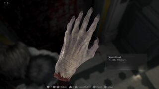 Resident Evil 9 Requiem: How to use the Severed Hand