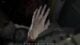 Resident Evil Requiem Severed Hand explainer