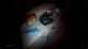 Silent Hill Townfall: The Patient surgery puzzle solution